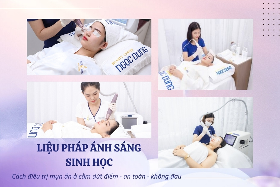 Áp dụng các biện pháp công nghệ cao là cách trị mụn ẩn dưới da ở cằm hiệu quả nhất