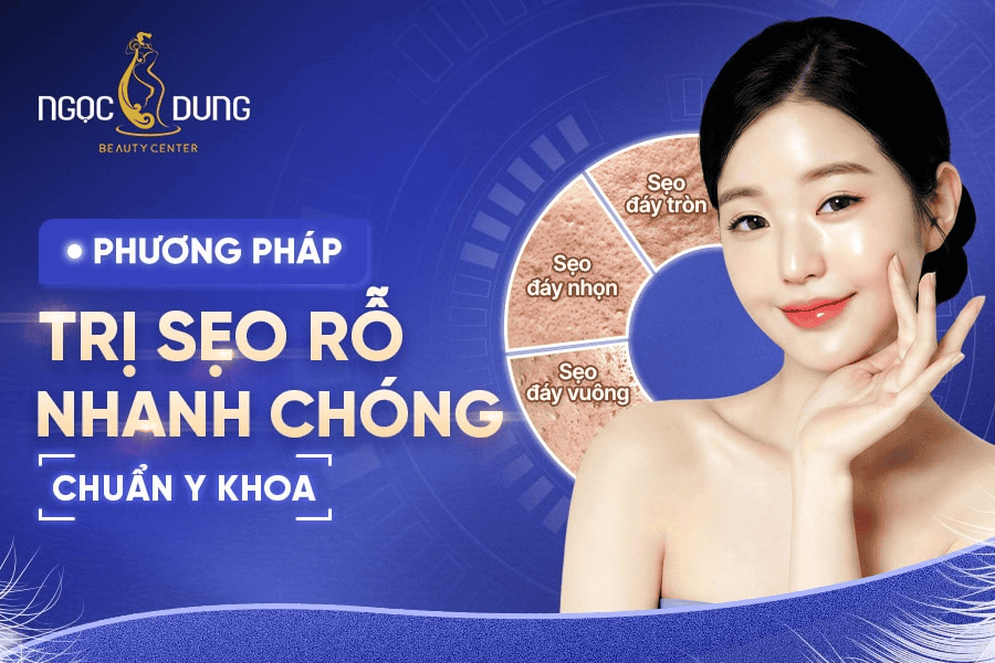 Liệu trình trị sẹo rỗ giá bao nhiêu? Bảng giá mới 2026 2 Trị sẹo rỗ bao nhiêu tiền? Bảng giá tham khảo chi tiết