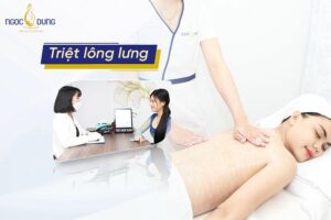 triệt lông lưng