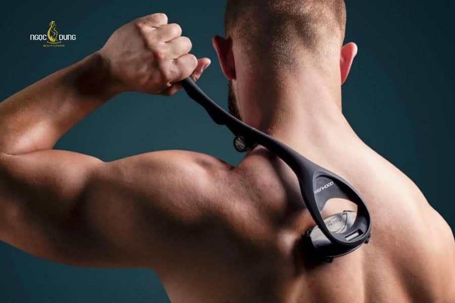 Cạo lông lưng là phương pháp truyền thống được lựa chọn nhờ tính nhanh chóng và chi phí thấp