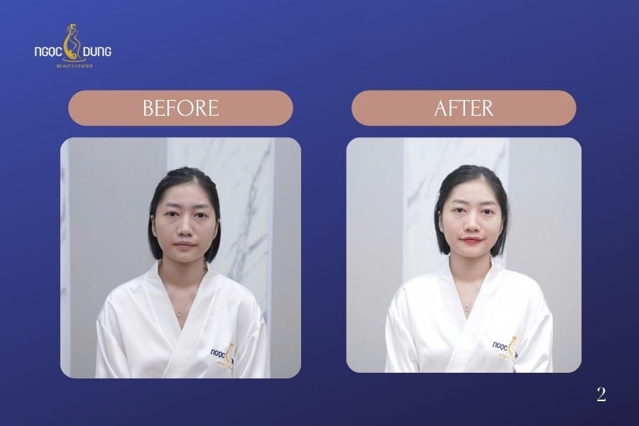 Ngọc Dung giúp khách hàng nhanh chóng sở hữu đôi môi hồng hào, tươi tắn với trải nghiệm nhẹ nhàng và an tâm