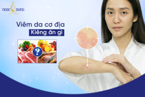 viem da co dia kieng an gi