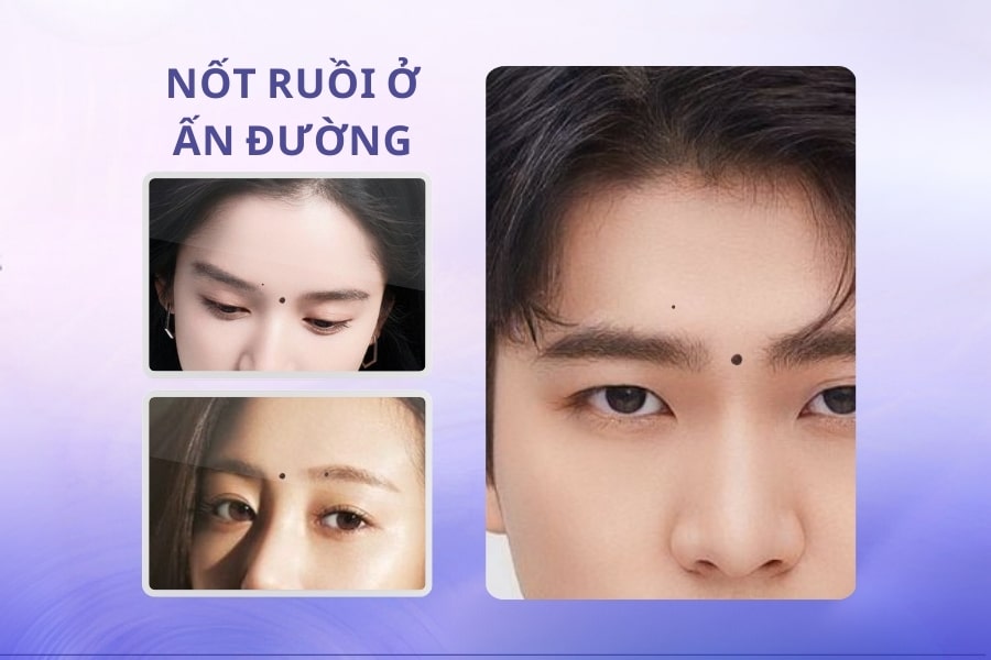 Nốt ruồi đen ở ấn đường - Lận đận tình duyên, sự nghiệp lao đao