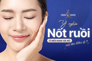 Ý nghĩa nốt ruồi ở mũi nam, nữ nói lên điều gì?