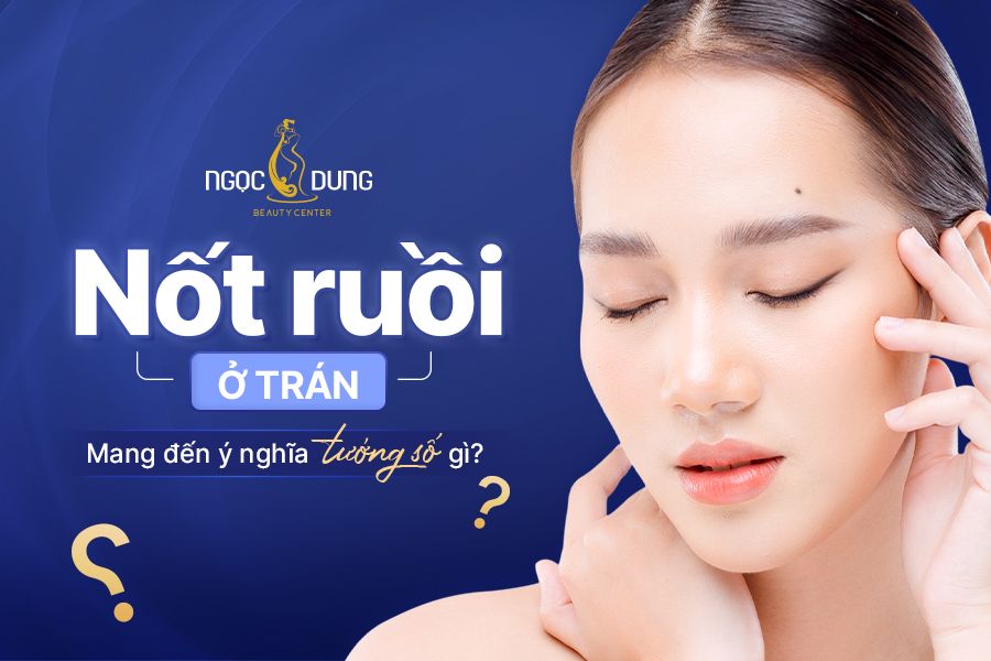 Nốt ruồi ở trán của cả nam và nữ mang những ý nghĩa gì?