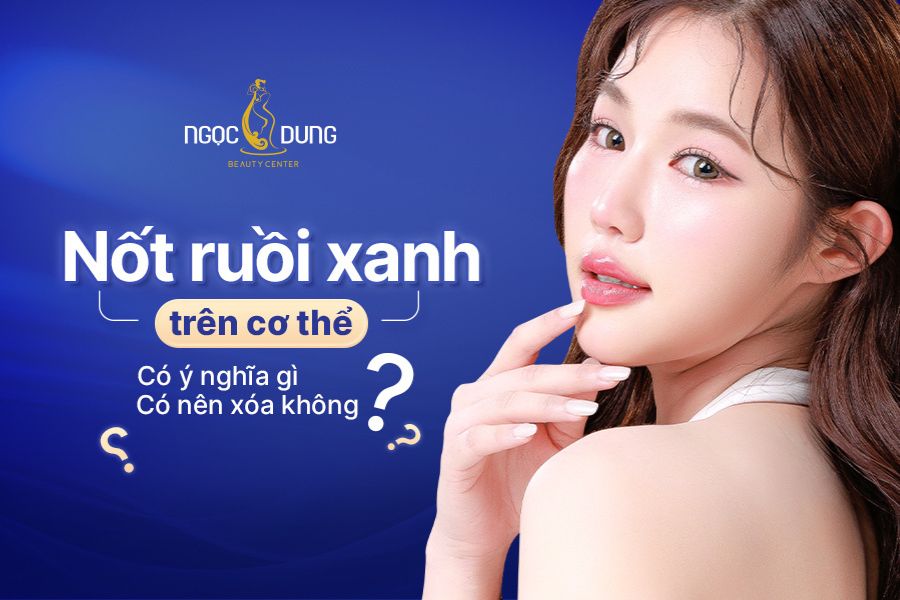 Nốt ruồi xanh trên cơ thể có ý nghĩa gì? Có nên xóa không?