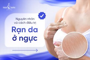 Banner SEO Ran da nguc 900 x 600 19.1 2