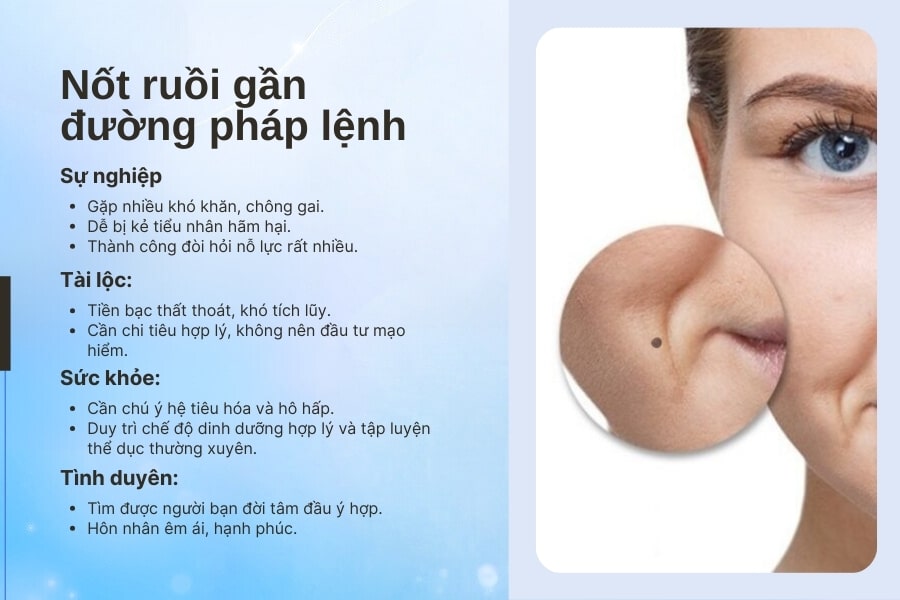 Nốt ruồi gần đường pháp lệnh - Cẩn trọng tiểu nhân hãm hại