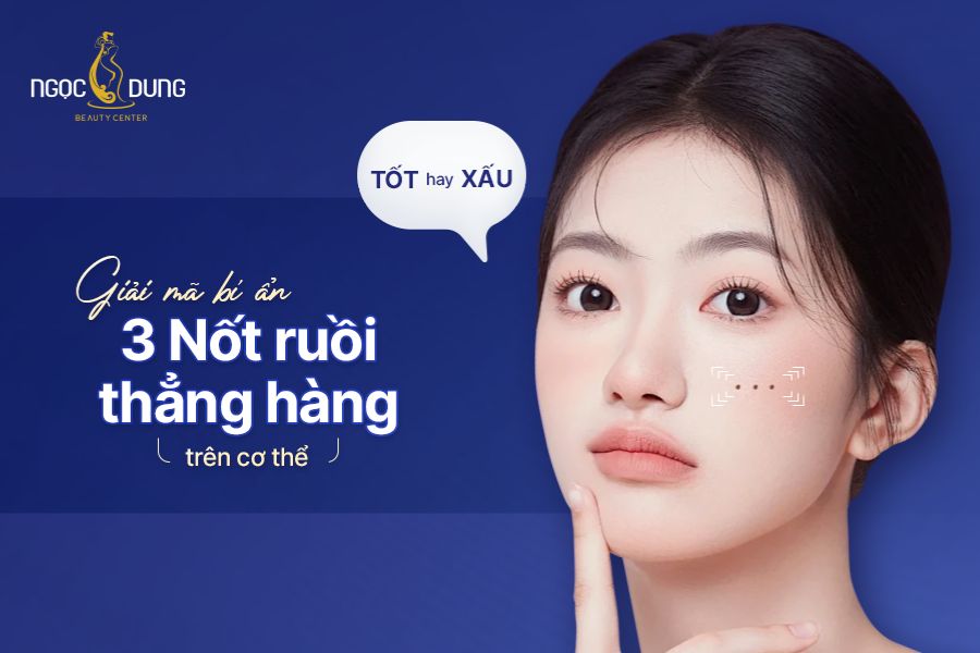 3 nốt ruồi thẳng hàng mang những ý nghĩa đặc biệt gì?