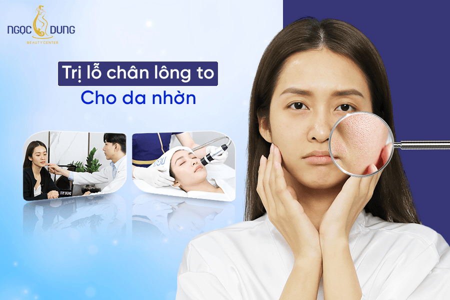 Cách trị lỗ chân lông to cho da nhờn hiệu quả tận gốc