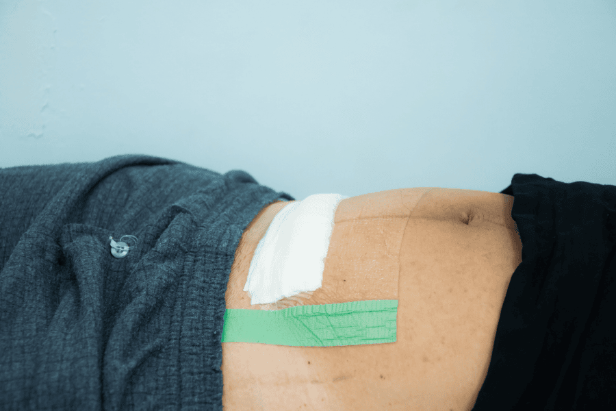 Khi quá trình chăm sóc không đảm bảo sẽ dẫn đến bị nhiễm trùng 