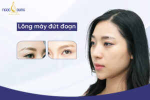 Nhìn tướng lông mày đứt đoạn đoán ngay tính cách, vận mệnh