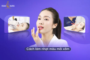 Nguyên nhân và 6 cách làm nhạt màu môi xăm nhanh chóng