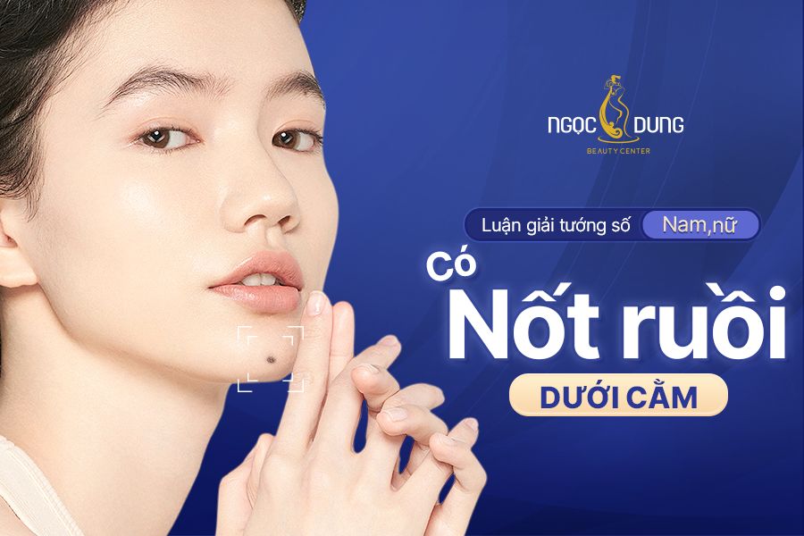 Nốt ruồi ở cằm nói lên điều gì?