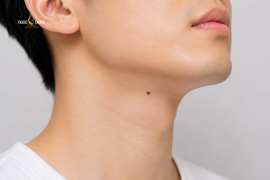 Nốt ruồi ở cằm mang ý nghĩa gì? Giải mã tướng số nam nữ 10 Nam giới có nốt ruồi ở nọng cằm thường dễ đạt được mục tiêu sự nghiệp