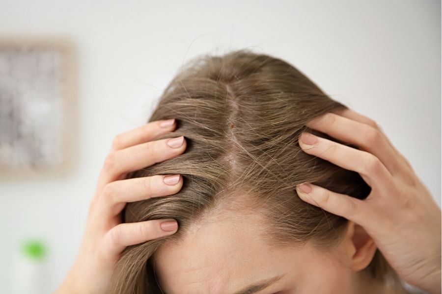 Người có nốt ruồi ở đầu trong tóc thường gặp thuận lợi trên con đường sự nghiệp lẫn chuyện tình cảm 