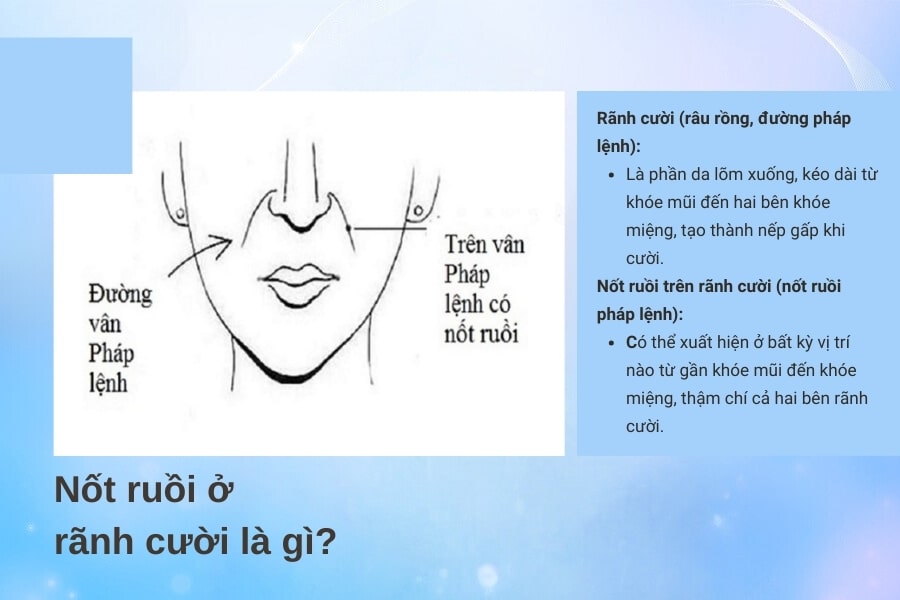 Thế nào là nốt ruồi rãnh cười? Nó nằm ở đâu?