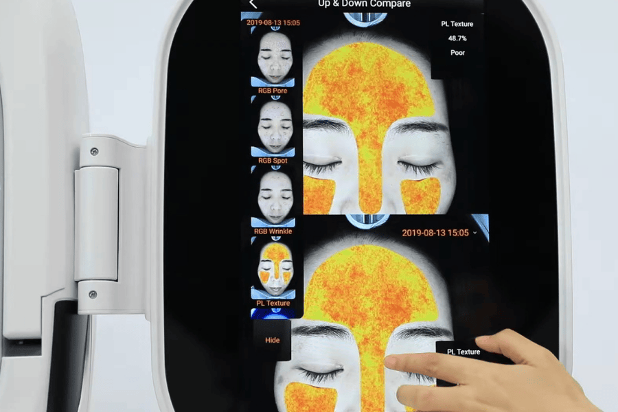  Sử dụng thiết bị quét da thế hệ mới để xác định loại da và tình trạng da