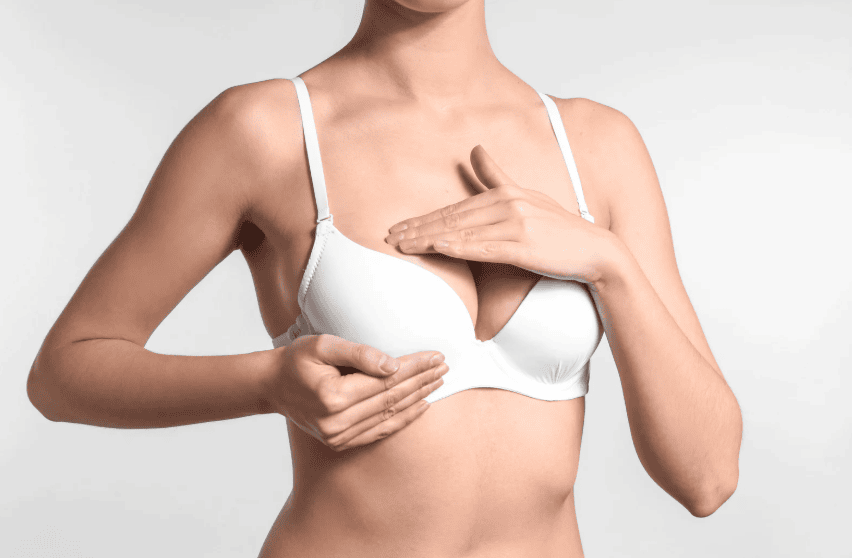 Vết rạn da ở ngực không thể tự hết nếu không được can thiệp đúng cách 