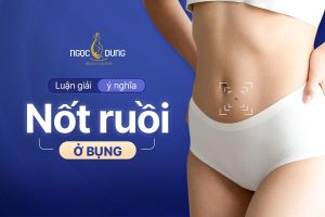 Nốt ruồi ở bụng