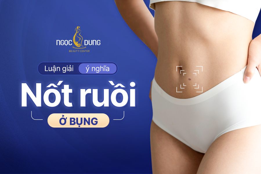 Vén màn bí mật nốt ruồi ở bụng - Có nên xóa không?