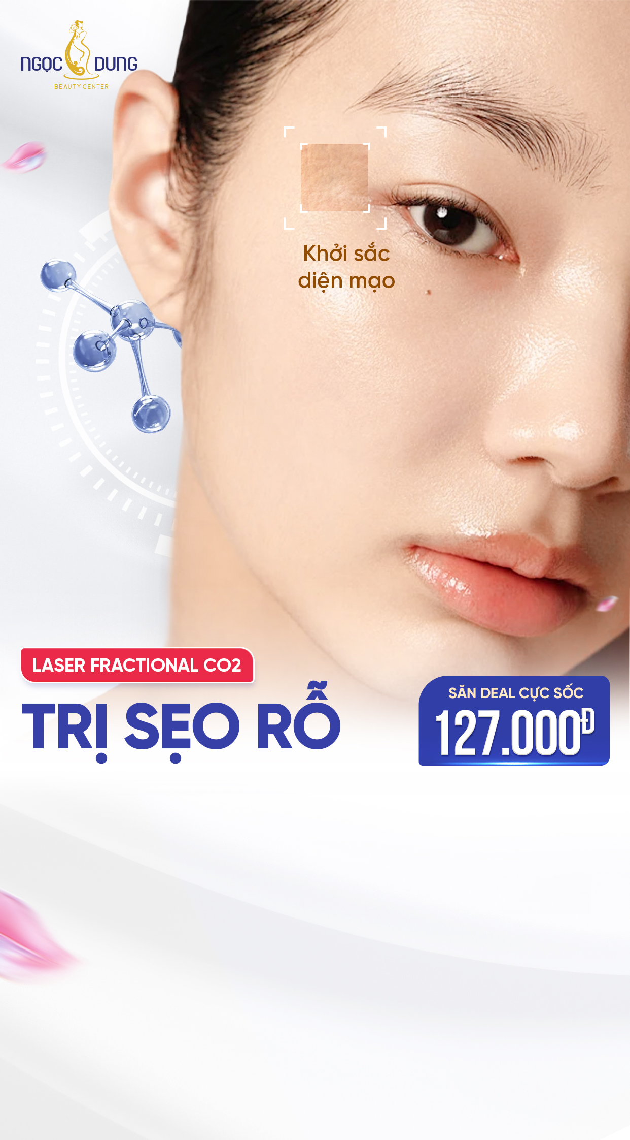 ưu đãi trị sẹo rỗ