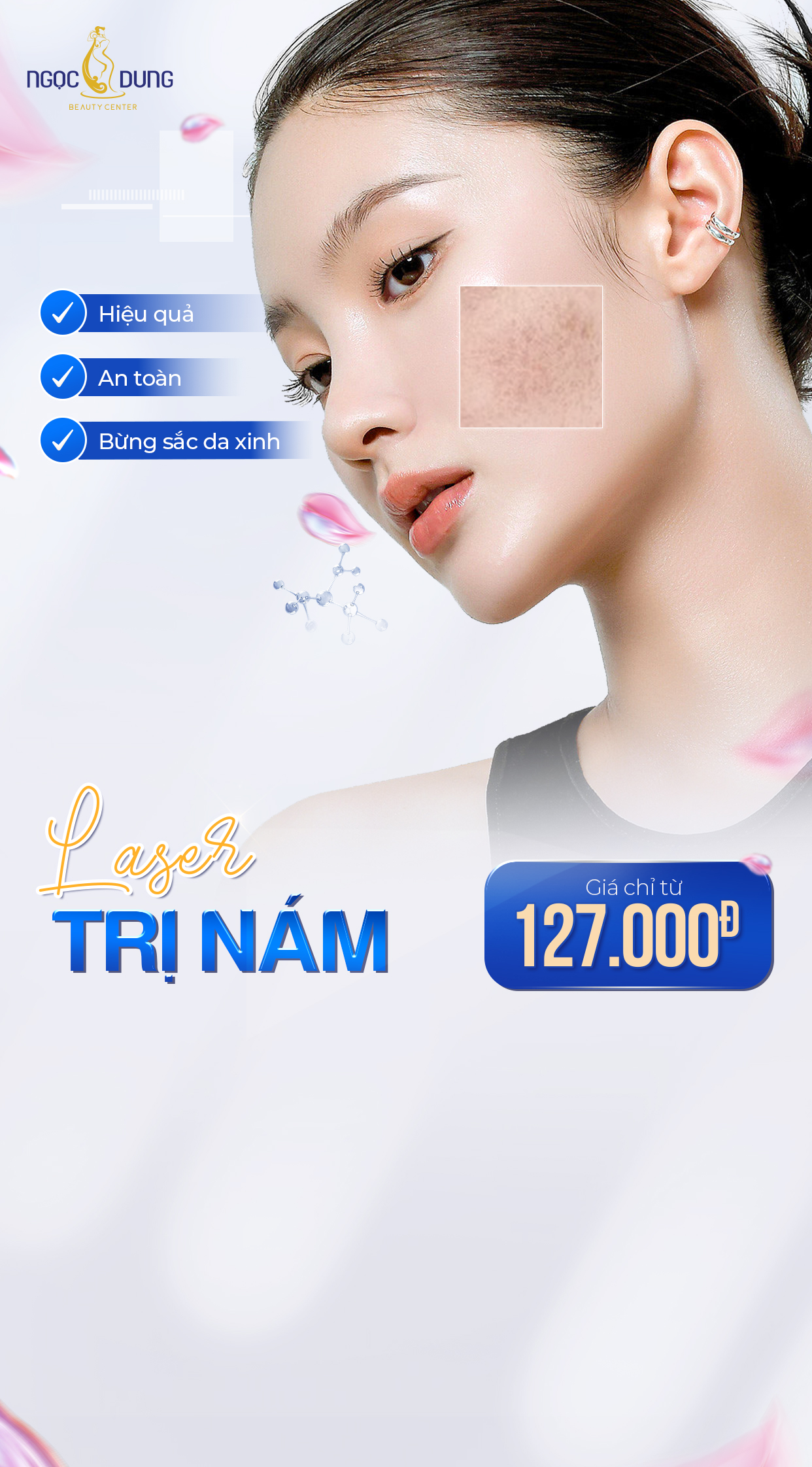 ưu đãi trị nám