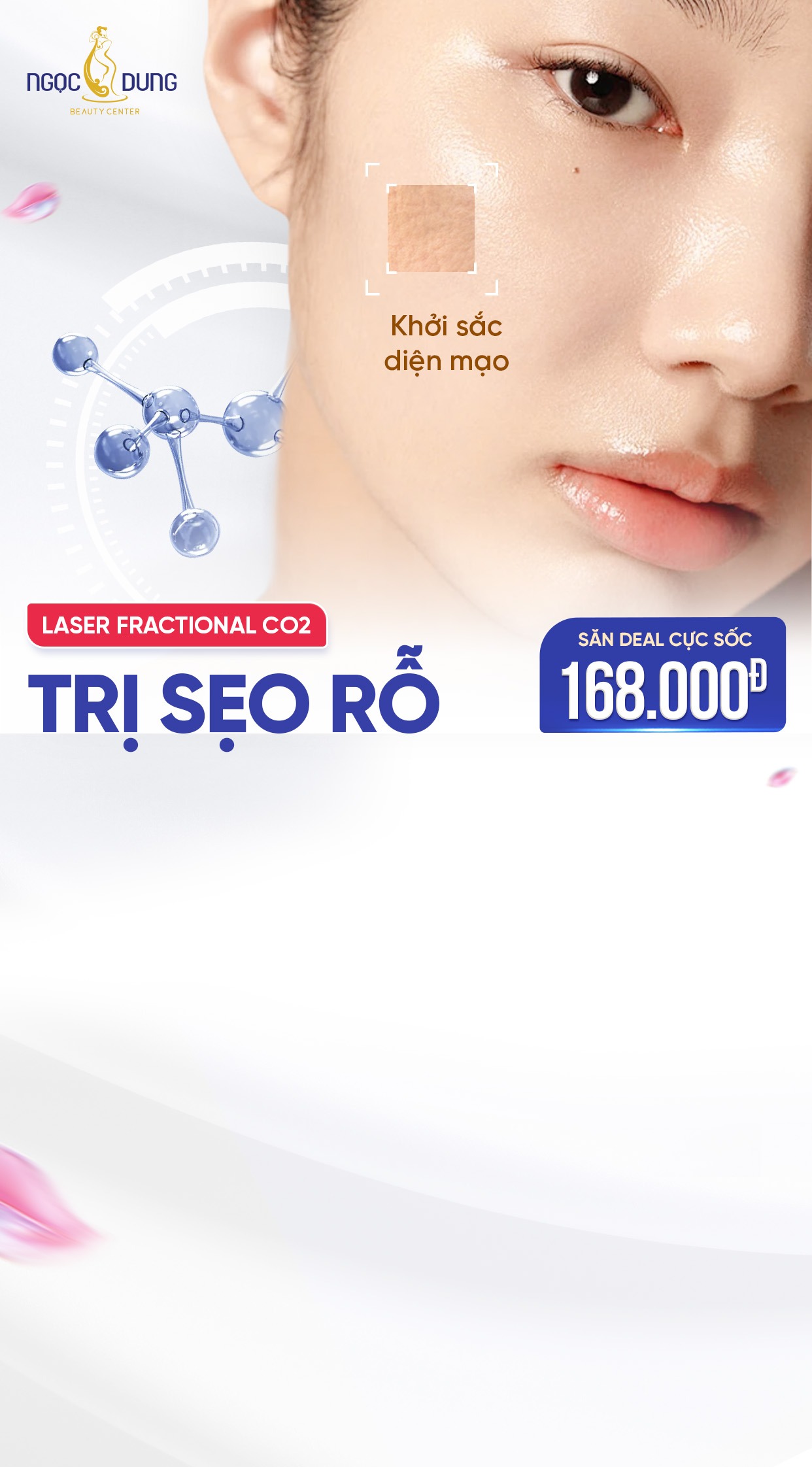 Lead trị sẹo rỗ tháng 4 2025
