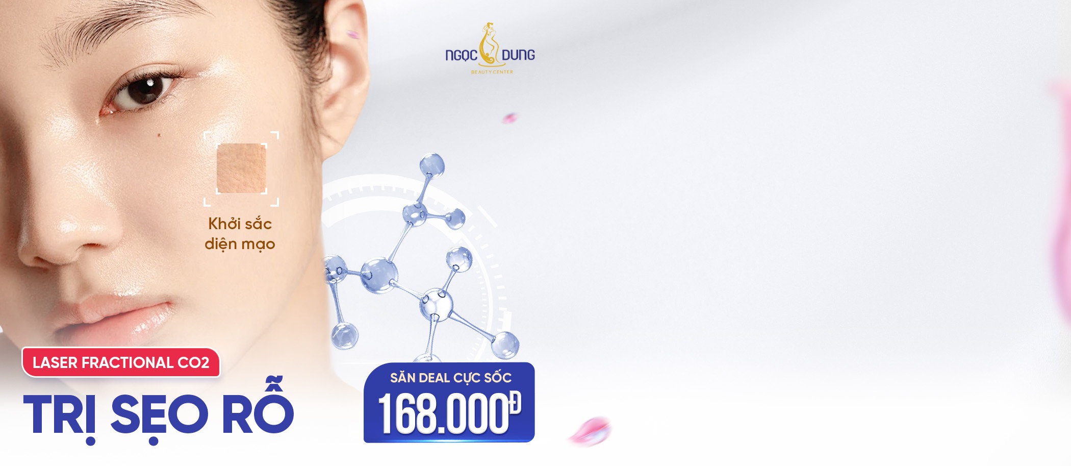 Lead trị sẹo rỗ tháng 4 2025