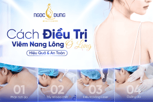 20260304 Pos SEO 832 2