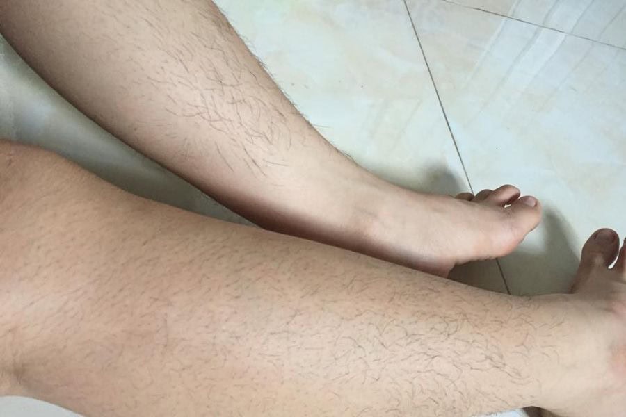 Lông thường mọc lại sau khi tẩy