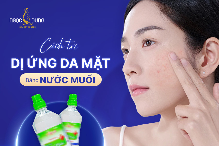 Cách trị dị ứng da mặt bằng nước muối