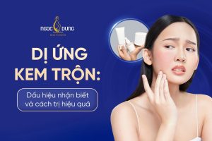 Dị ứng kem trộn