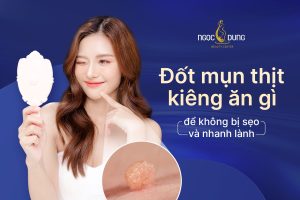 Đốt mụn thịt kiêng ăn gì? Cùng chuyên gia da liễu giải đáp ngay
