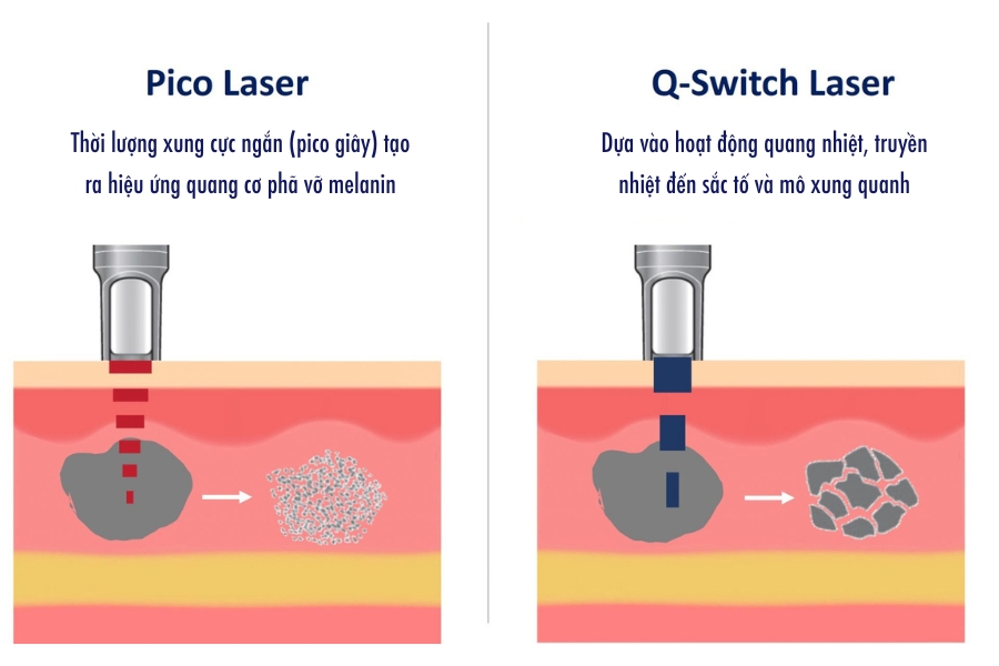 Ưu điểm - Nhược điểm của công nghệ laser pico là gì?