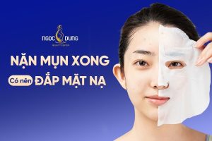 Nặn mụn xong có nên đắp mặt nạ không? Cùng chuyên gia giải đáp ngay