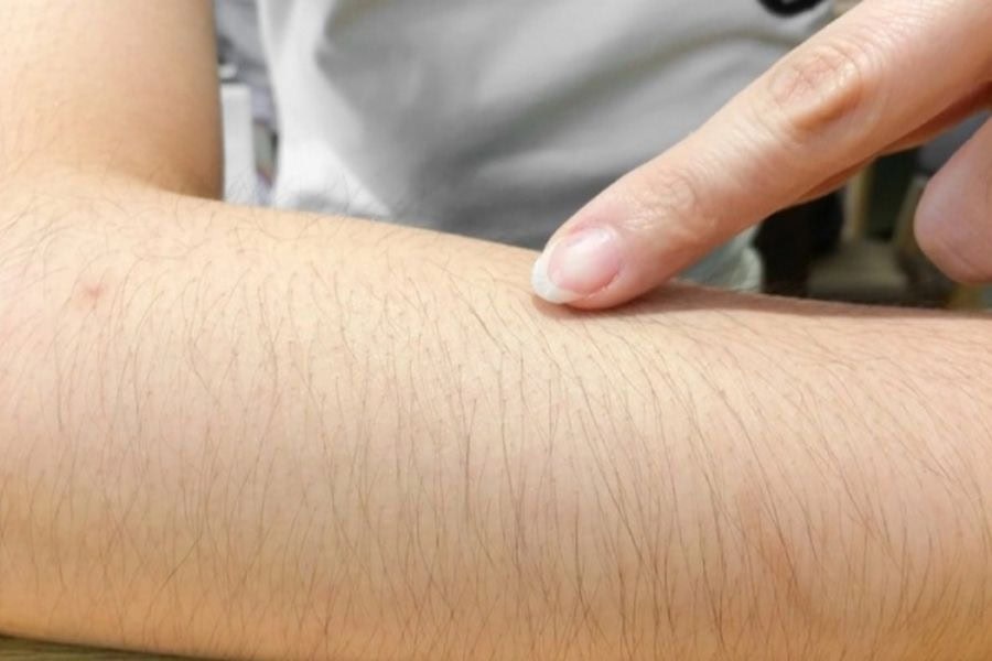 Bôi gì để lông không mọc lại? Bí kíp giúp da mịn màng 3 Lông không thực sự “mọc nhiều hơn” mà mọc lại theo cơ chế tự nhiên của cơ thể