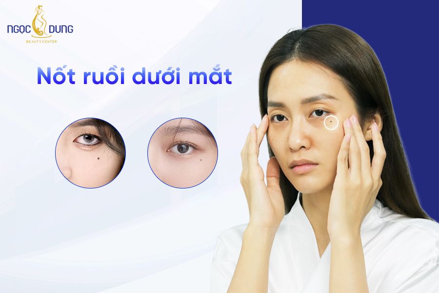 Nốt ruồi dưới mắt nam, nữ - Luận giải chi tiết tướng số, vận mệnh