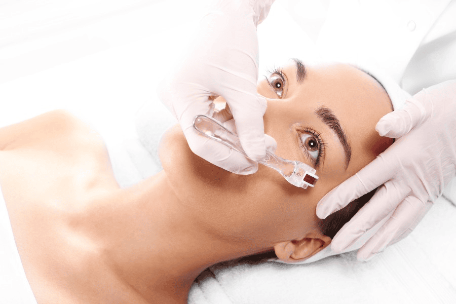 Sẹo lõm lâu năm có trị được không? Giải đáp từ chuyên gia 12 Phương pháp lăn kim giúp các dưỡng chất thấm sâu và kích thích tái tạo da