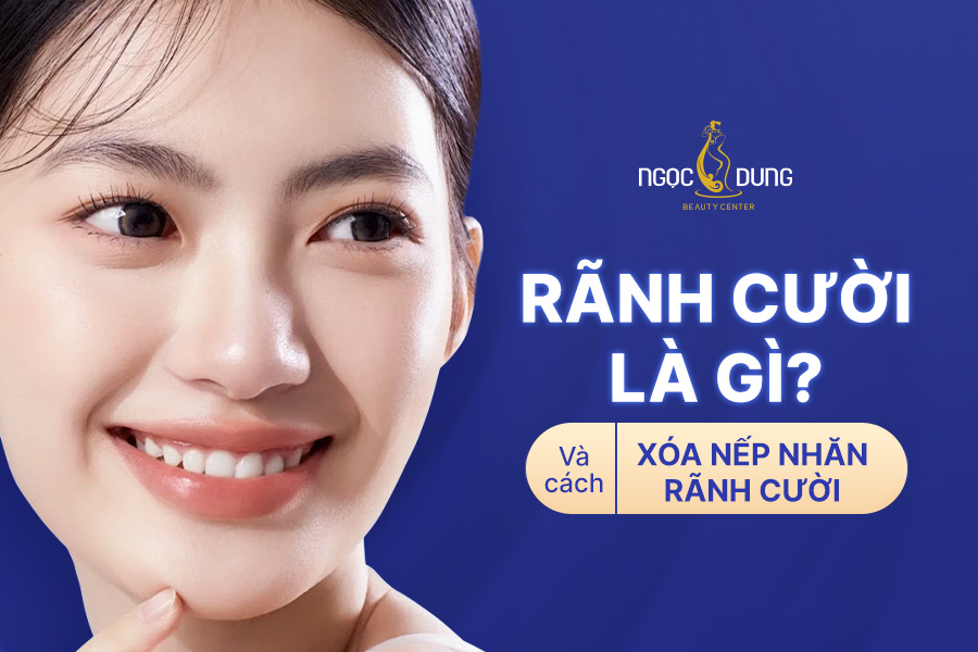 Rãnh cười