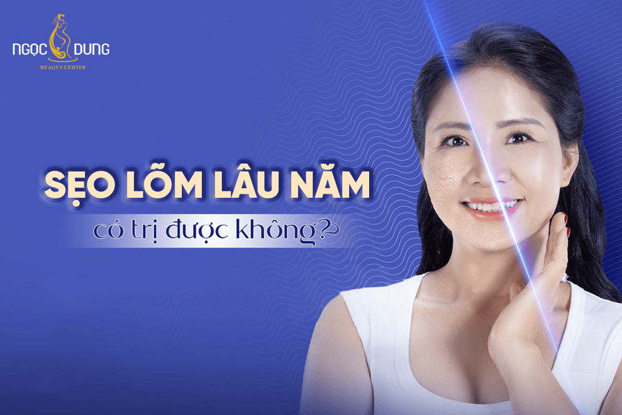 Sẹo lõm lâu năm có trị được không? Giải đáp từ chuyên gia 2 Sẹo lõm lâu năm có trị được không?