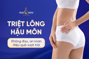 Triệt lông hậu môn