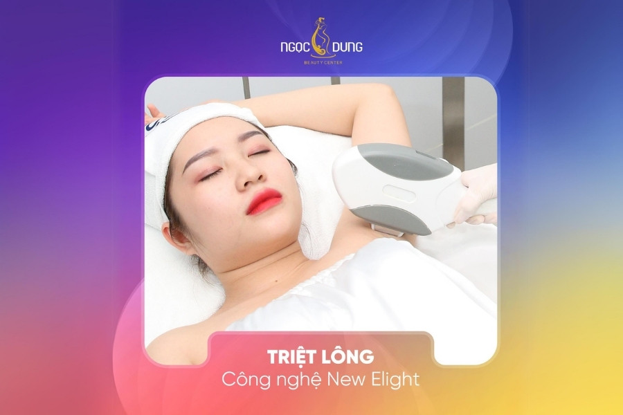 triet long toan than vinh vien voi cong nghe new elight