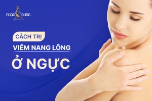 viêm nang lông ở ngực