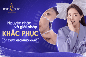 20260305 Pos SEO 898 1