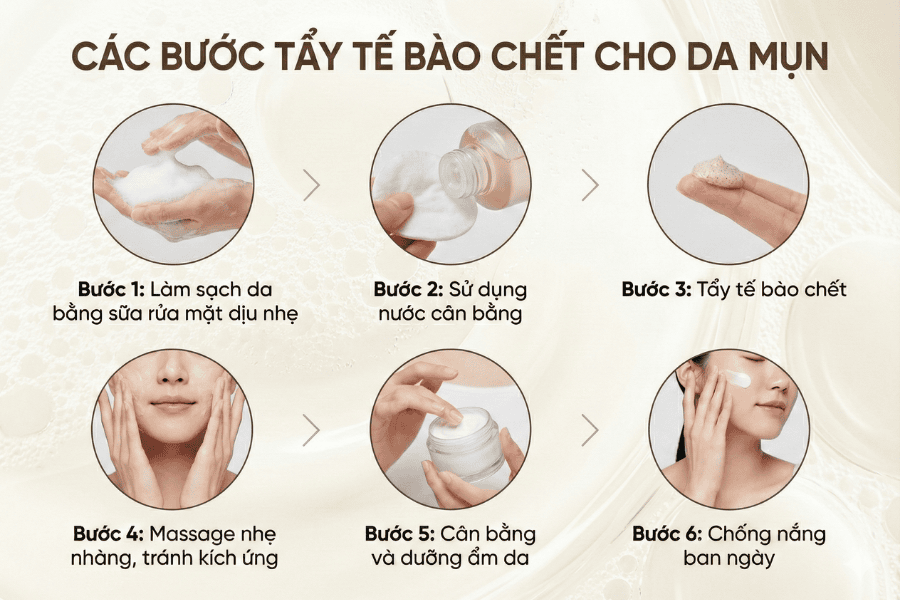 Các bước tẩy tế bào chết cho da mụn