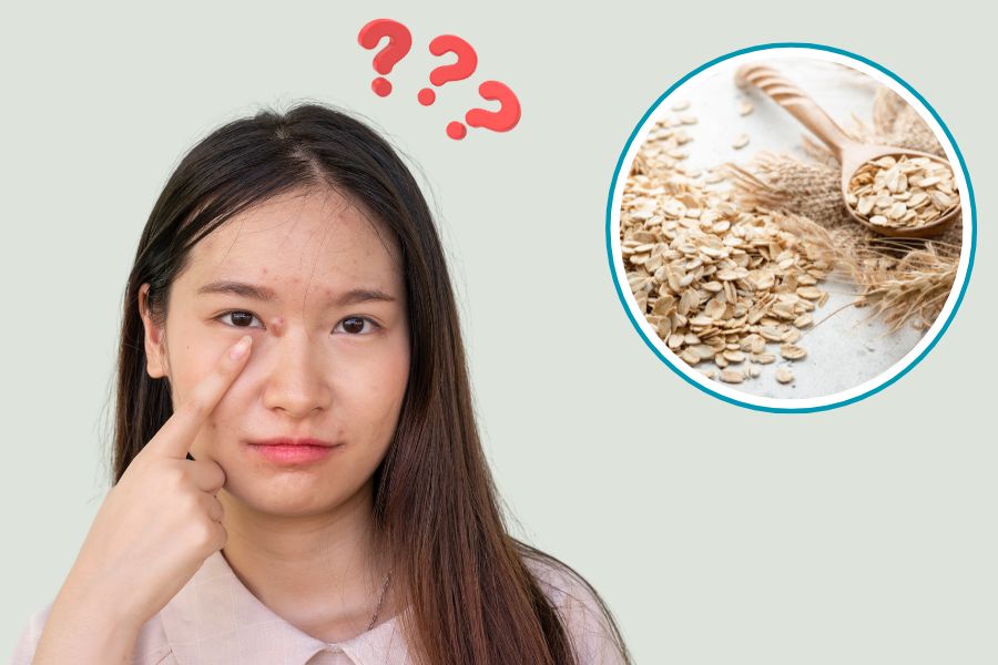 Không phải ai cũng phù hợp với việc trị mụn bằng bột yến mạch