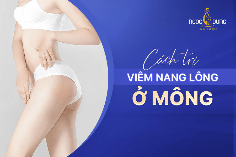 Cách trị viêm nang lông ở mông hiệu quả dứt điểm và an toàn 