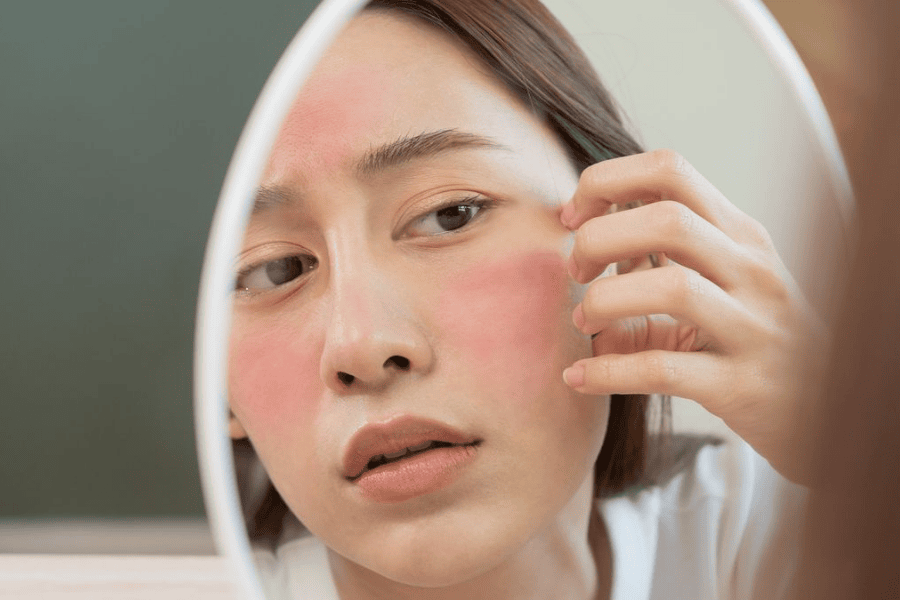 Khô da dễ hình thành các nếp nhăn gây ra tình trạng lão hóa sớm