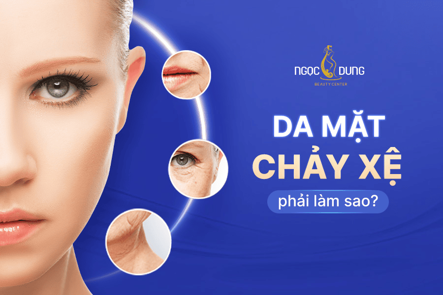 Da chảy xệ chùng nhão: Nguyên nhân và giải pháp khắc phục 2 Da mặt chạy xệ phải làm sao?